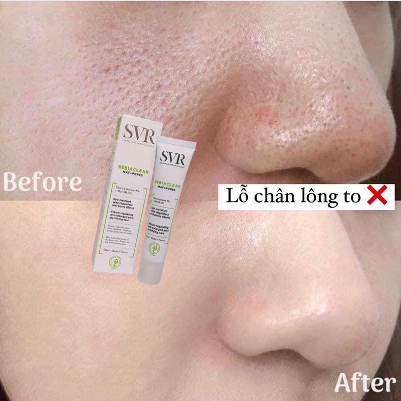 KEM DƯỠNG KIỀM DẦU SE KHÍT LỖ CHÂN LÔNG SVR SEBIACLEAR MAT + PORES 40ML