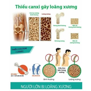 CANXI DẠNG BỘT HÒA TAN TRẺ EM_ TIENS