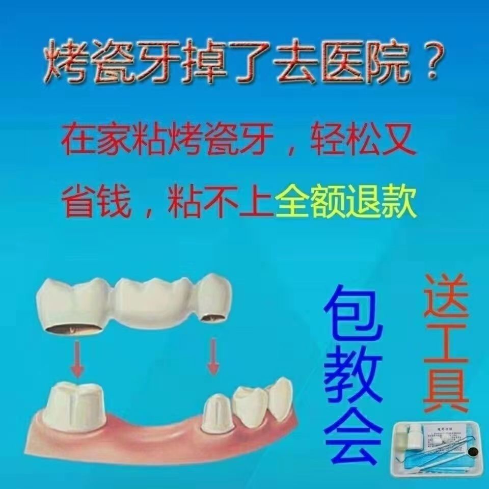 Keo Sứ Dính Cố Định Răng Kim Loại 9.8
