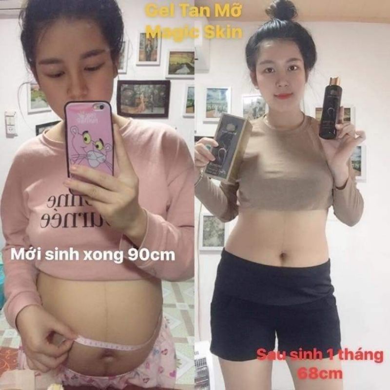 [SẢN PHẨM MỚI] KEM TAN MỠ MAGICSKIN GIẢM MỠ BỤNG,HỖ TRỢ TRỊ RẠN DA