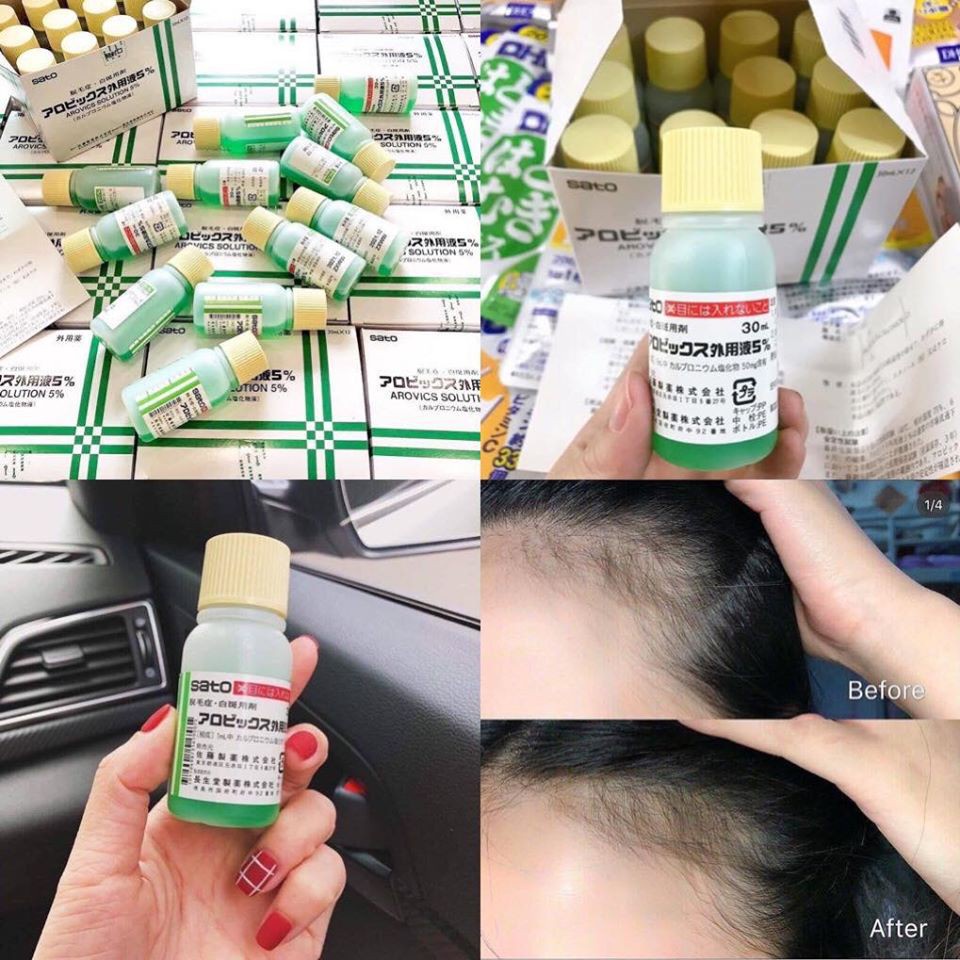 Tinh Chất Kích Thích Mọc Tóc SATO Thảo Dược Nhật Bản - 30ml