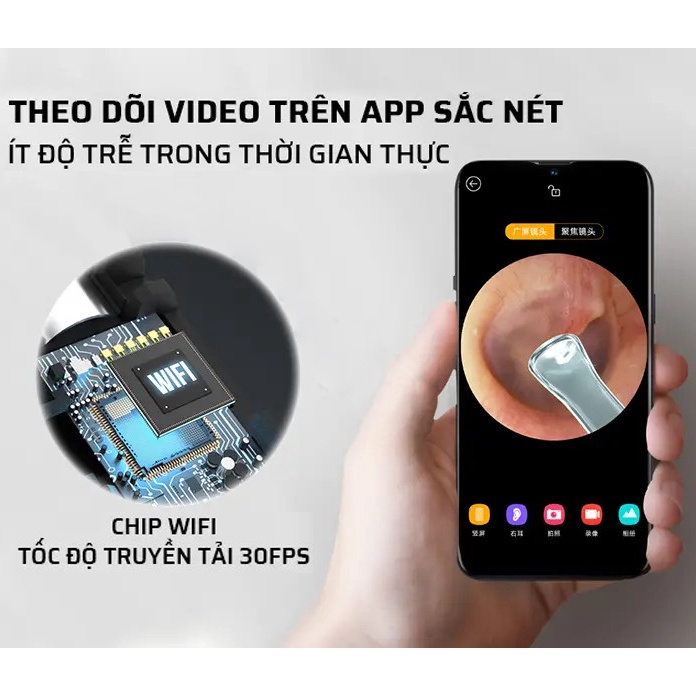 Dụng cụ lấy ráy tai Xiaomi Bebird R1 có camera mini siêu nét, xem hình ảnh trực tiếp qua app- Máy lấy ráy tai thông minh