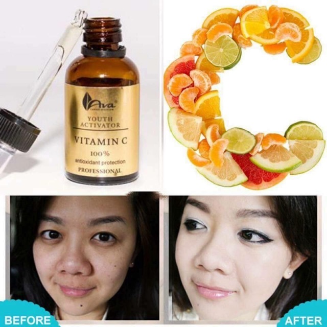 Serum trắng da AVA Vitamin C 👏👏👏