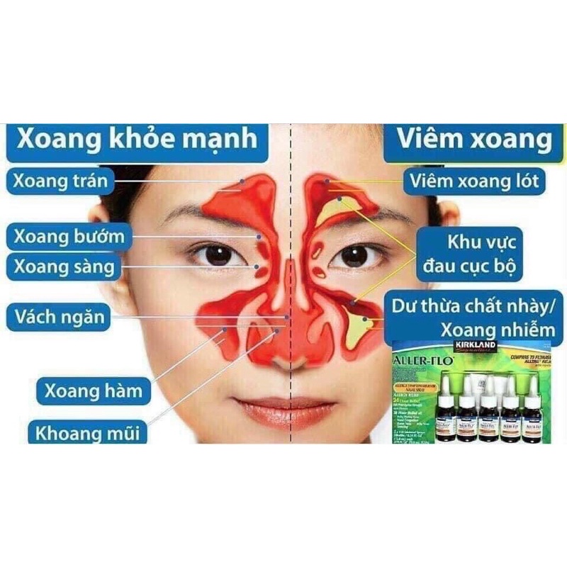 Xịt xoang mũi Kirkland Aller Flo Hàng Mỹ chính hãng