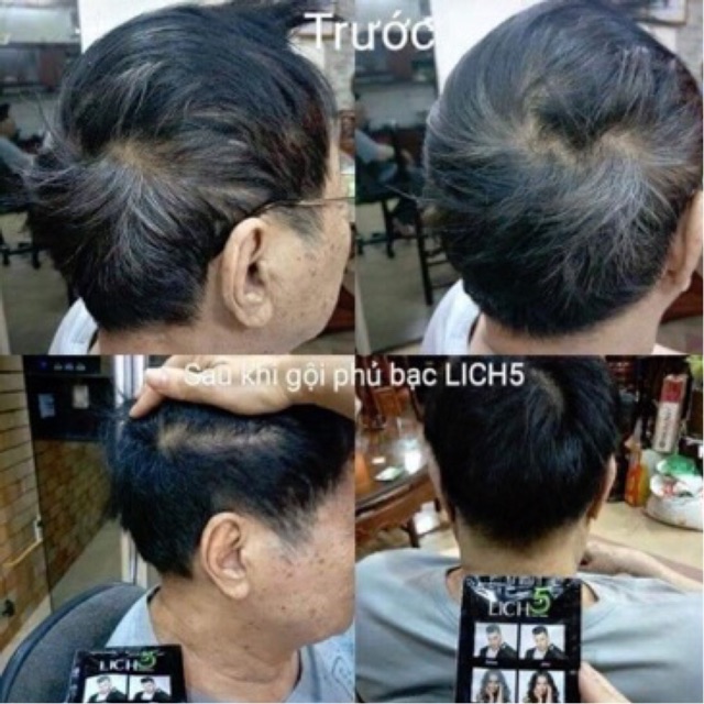 FREESHIP Dầu gội phủ bạc thảo dược Lịch 5[ Dầu gội an toàn nhất] | BigBuy360 - bigbuy360.vn