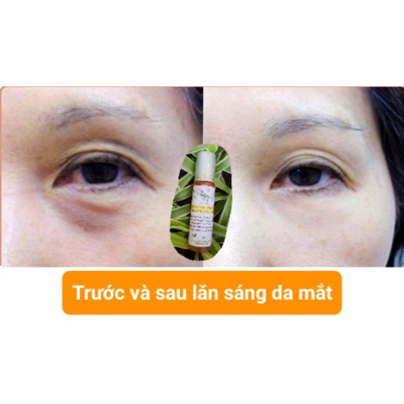 Dầu lăn dưỡng sáng da mắt, thâm mụn, sẹo (handmade)