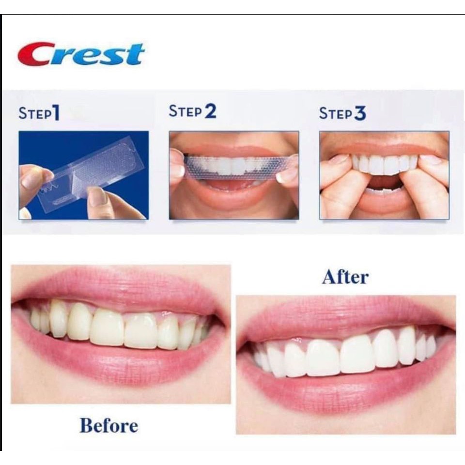 [Hàng trả order, không có dư] Miếng dán trắng răng Crest 3D