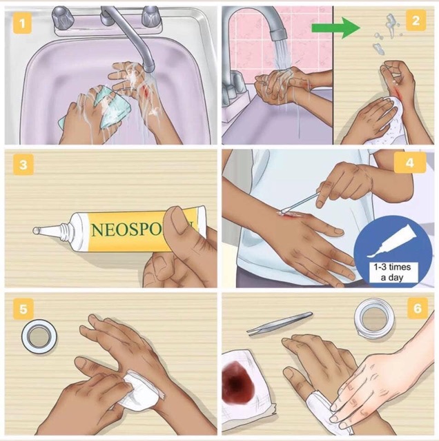 NEOSPORIN - thuốc mỡ số 1 về da, giúp làm lành vết thương bỏng và chống sẹo hiệu quả, vết côn trùng cắn