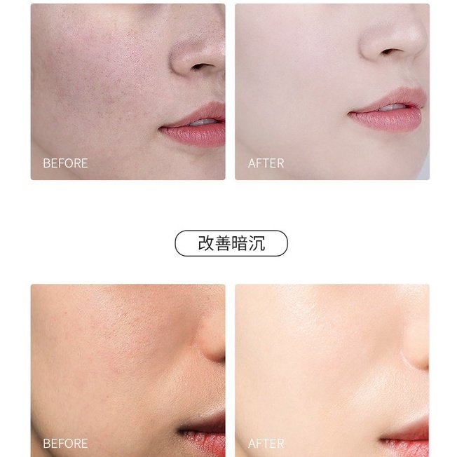 Mặt Nạ Bùn Lột Mụn Đầu Đen Dưỡng Ẩm Làm Sạch Lỗ Chân Lông