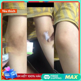 Kem mờ thâm OL-Cell Hàn Quốc