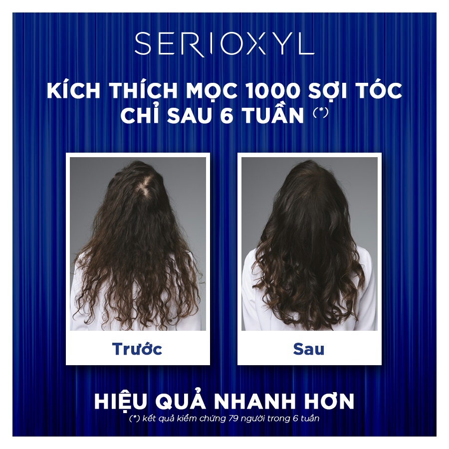Dầu gội tóc thưa mảnh rụng Loreal SERIOXYL 1500ml-500ml-300ml-100ml