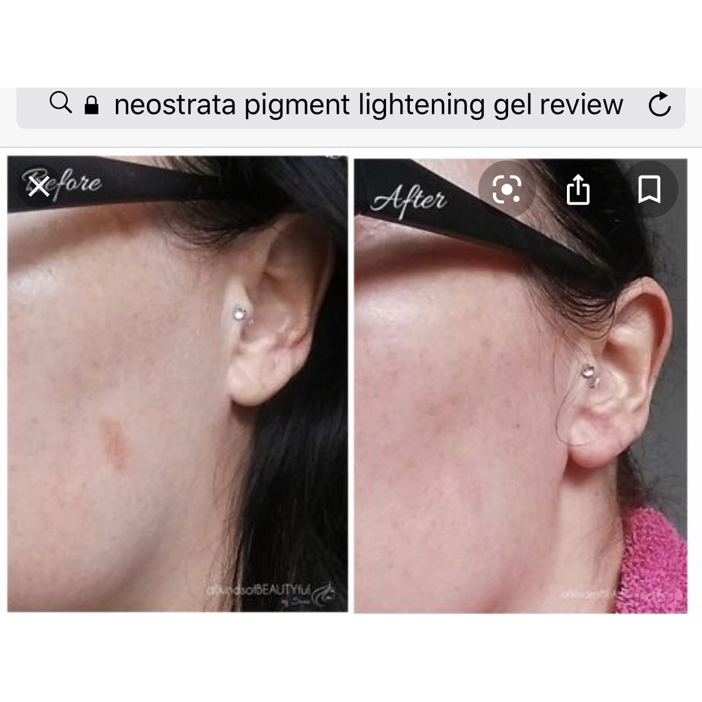 Gel Giảm Thâm Nám Sáng Da NeoStrata Pigment Lightening Gel 40ml