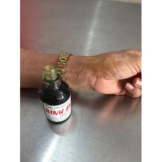 Combo 10 chai dầu   Bình  An 30ml