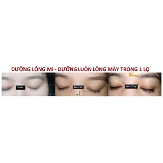 [CHÍNH HÃNG] Serum Dưỡng Mi Siêu Dài Zzvenus [Bản nâng cấp KING VENUS]