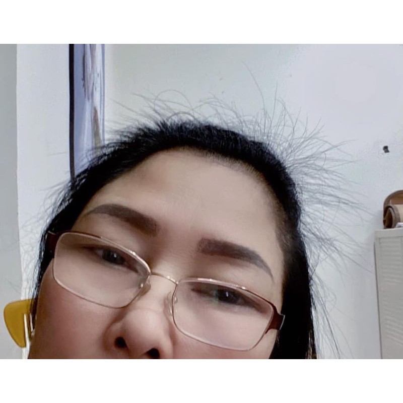 COMBO NGĂN RỤNG TÓC, KÍCH THÍCH MỌC TÓC H2A | BigBuy360 - bigbuy360.vn