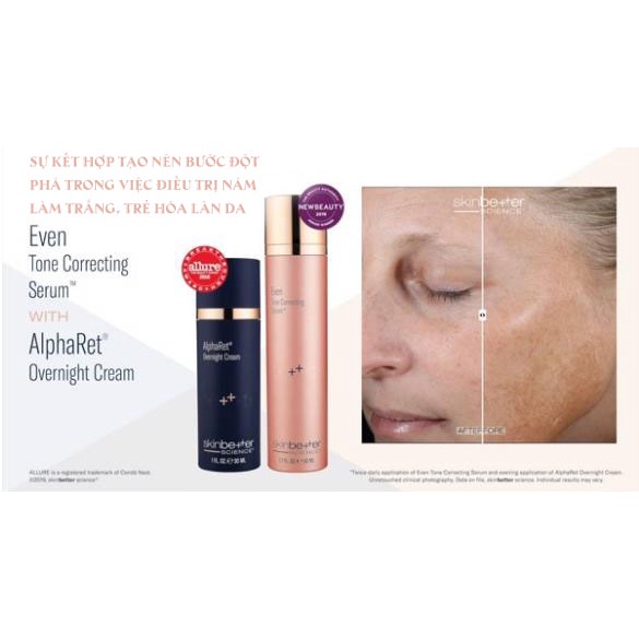 Kem đêm cải thiện chống lão hóa Skinbetter AlphaRet Overnight Cream