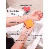 MEN VI SINH TAVIDA HẾT MỤN LƯNG, VIÊM NANG LÔNG, MẨN NGỨA