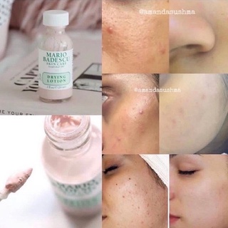 Dung Dịch Chấm Mụn Mario Badescu Drying Lotion 29ml
