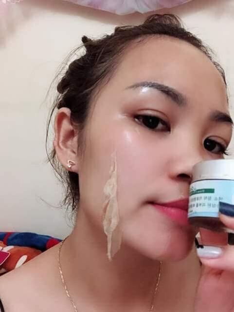 Mặt Nạ Màng Tế Bào Gốc Trắng Da Xóa Nám GoGo