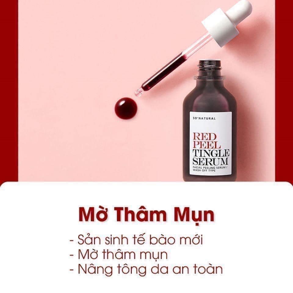 Serum Tái Tạo Phục Hồi Da Sinh Học So Natural Red Peel Tingle Serum