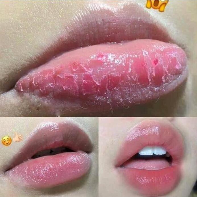 Kem làm hồng môi kem dưỡng môi mềm mại chăm sóc môi dưỡng môi mịn màng dưỡng ẩm sâu phục hồi môi nứt nẻ ngăn ngừa nứt