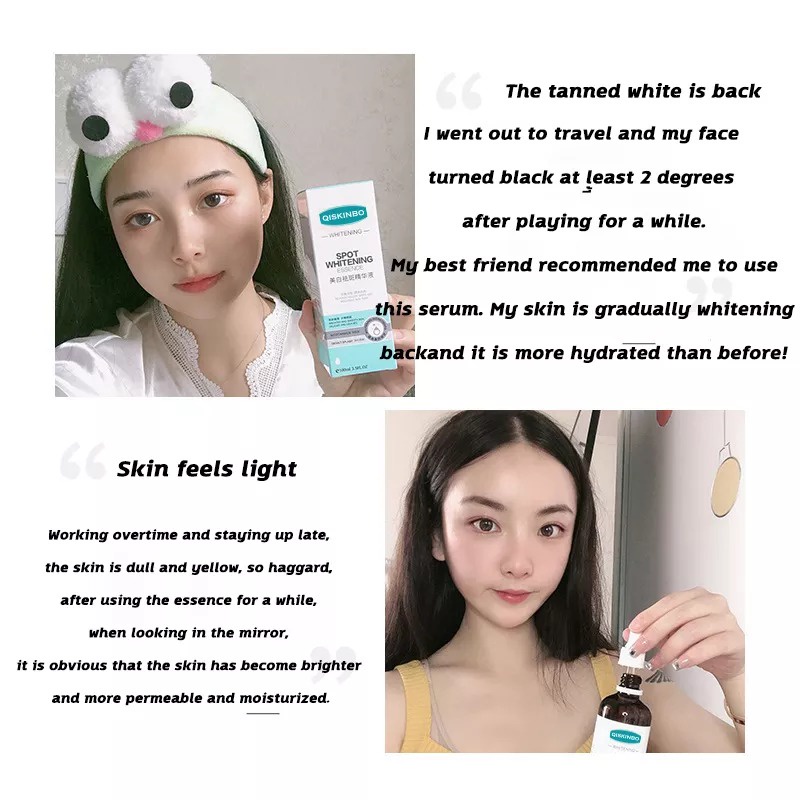 100ml kem dưỡng trắng da và loại bỏ tàn nhang - loại bỏ tinh chất làm sáng và giảm đốm niacinamide Dung dịch gốc chứa niacinamide dưỡng ẩm, làm dịu và phục hồi da mặt