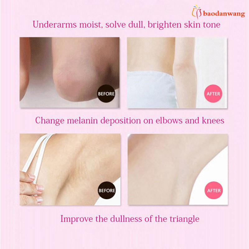 [Hàng mới về] Kem làm trắng vùng da dưới cánh tay hiệu quả