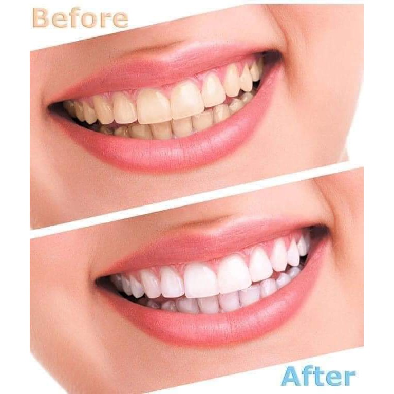 Bột đánh trắng răng Eucryl Toothpowder 50g