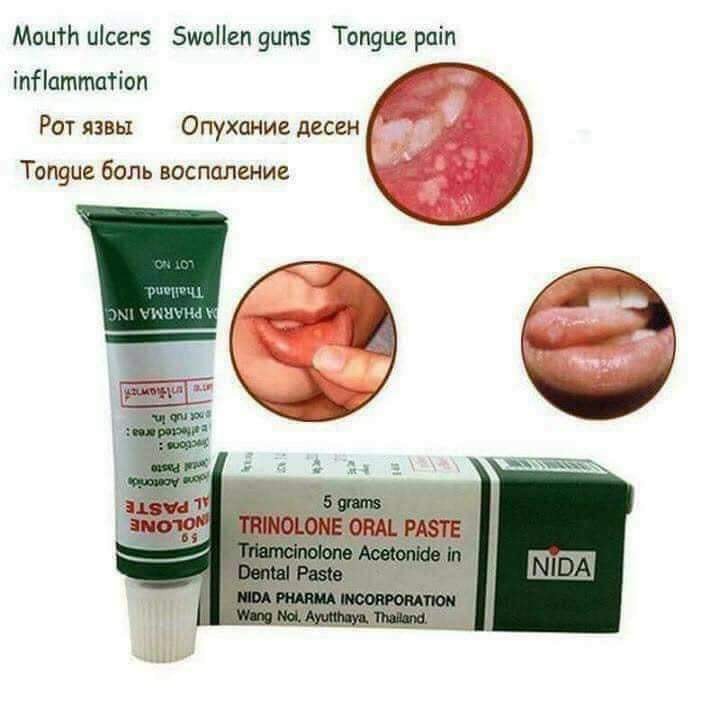 Kem Bôi Nhiệt Miệng Trinolone Oral Paste Thái Lan