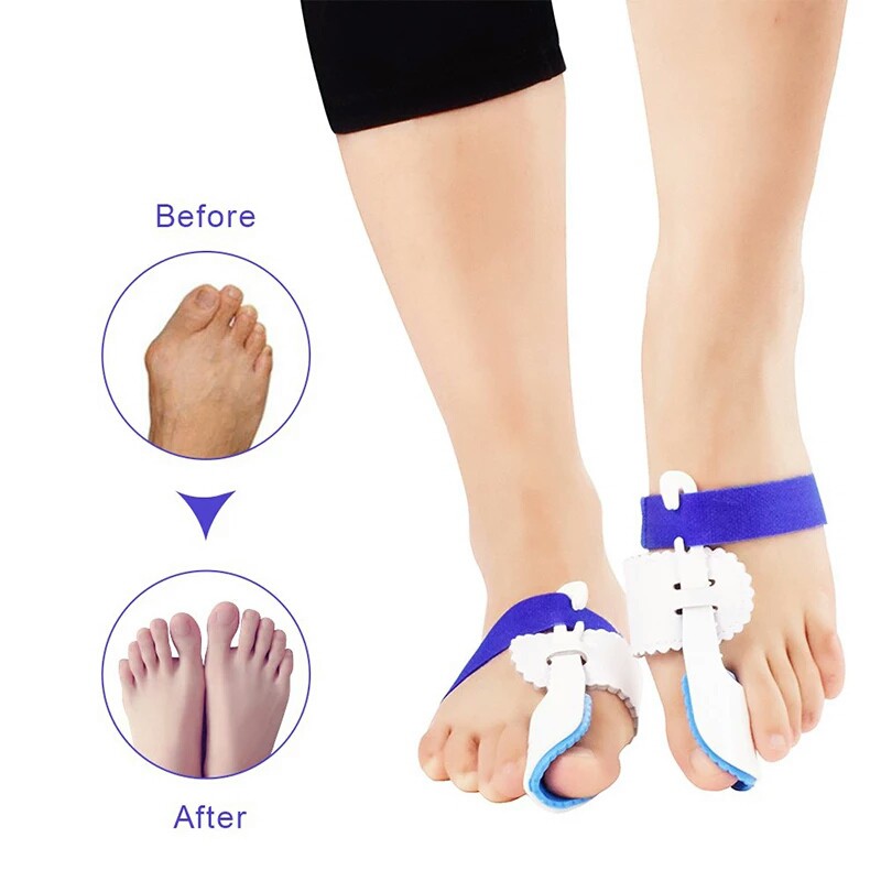 Dụng cụ nẹp định hình ngón chân cái