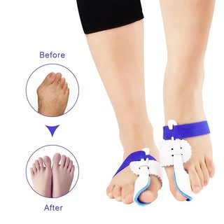 NẸP ĐỊNH HÌNH NGÓN CHÂN CÁI GIÚP THẲNG CHÂN AN TOÀN TIỆN LỢI