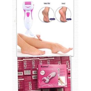 MÁY TRÀ GÓT CHÂN TẨY DA CHẤT GÓT CHÂN