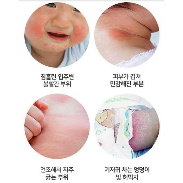 KEM DƯỠNG ẨM PHỤC HỒI DA VÀ KEM HĂM HỮU CƠ ORGABEBE CHO BÉ TỪ SƠ SINH