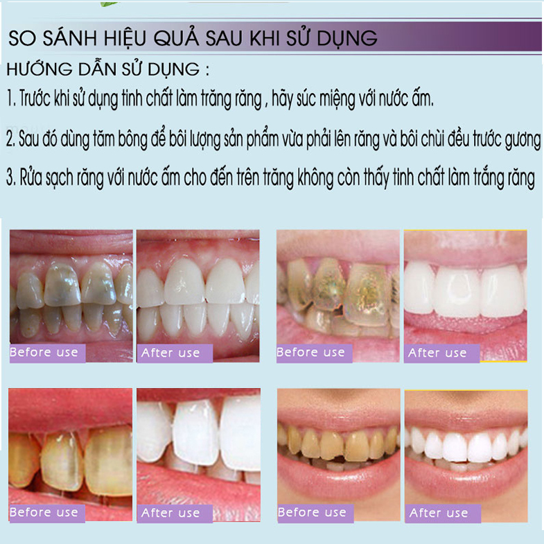 [Hàng Mới Về] Tinh Chất Trắng Răng RtopR  Làm Sạch Răng Teeth Cleaning