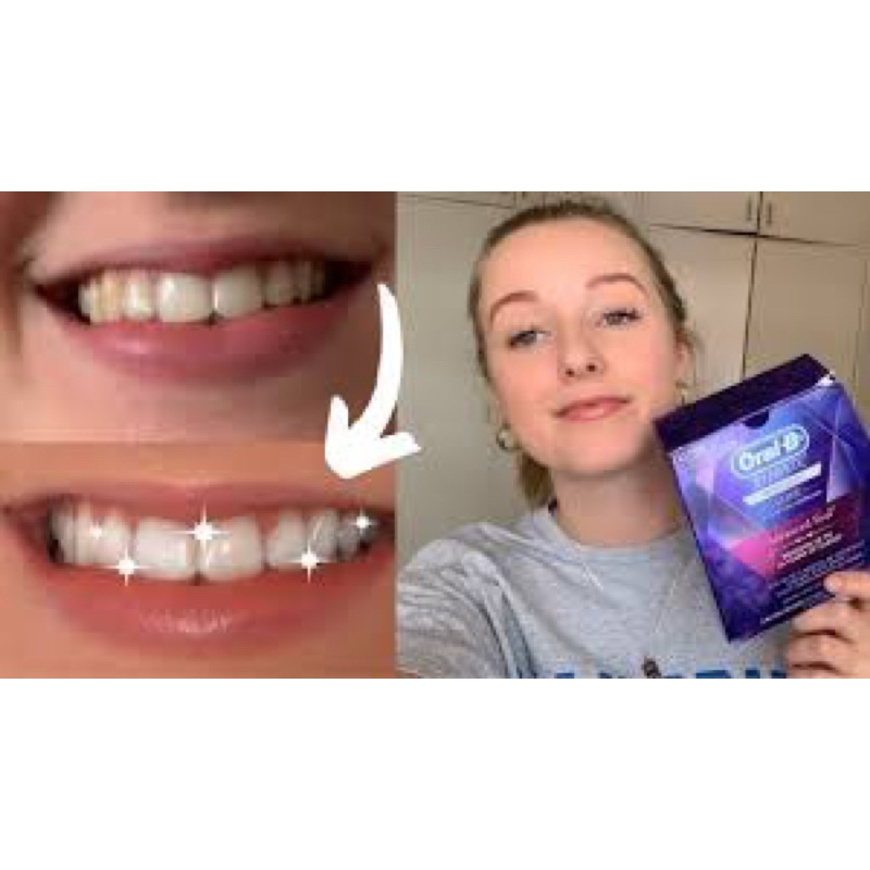 Miếng Dán Trắng Răng Oral-B 3D White Whitening Strips (28 miếng - Bill Úc)