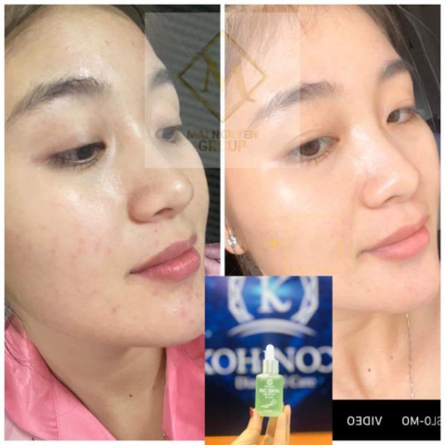 Ric Skin Serum Ha+ tem điện tử chính hãng