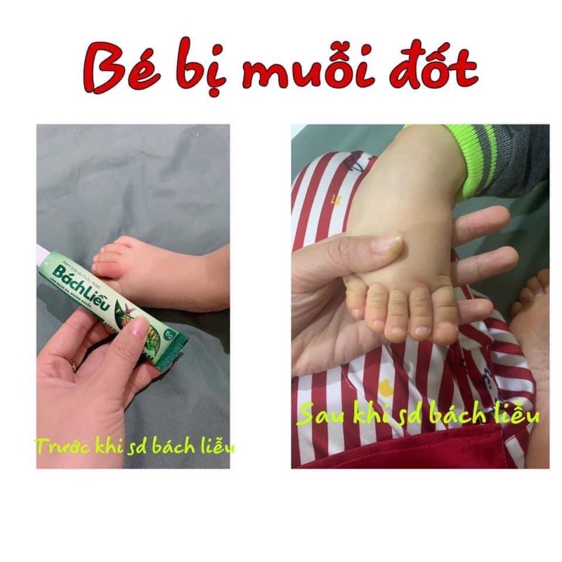 Kem bôi da thảo dược Bách Liễu