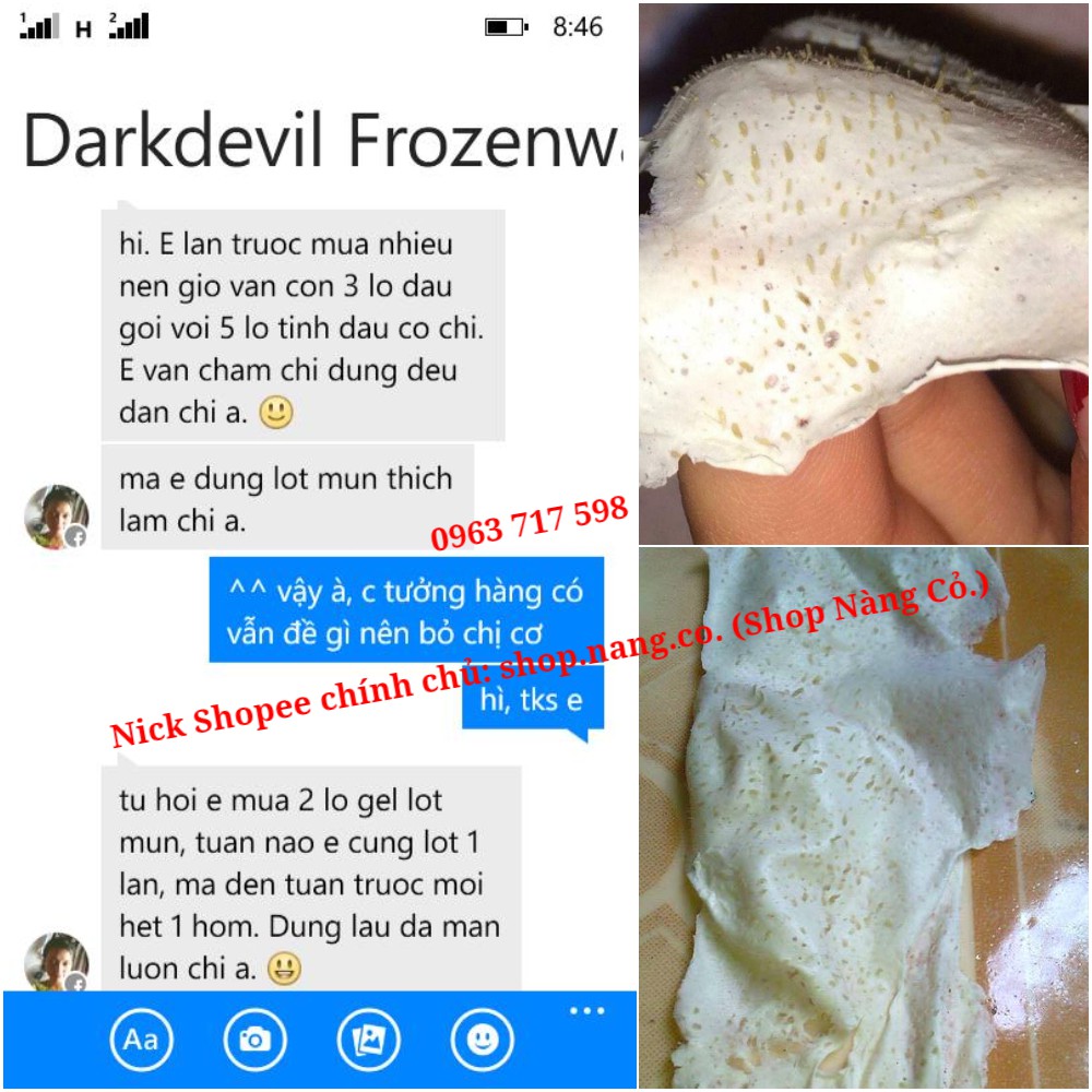 Gel Hút Mụn Bạc Hà, Mặt nạ Gel lột mụn Ngân Bình chính hãng gel lột mụn cám, mụn đầu đen, da chết, lông tơ, bụi bẩn