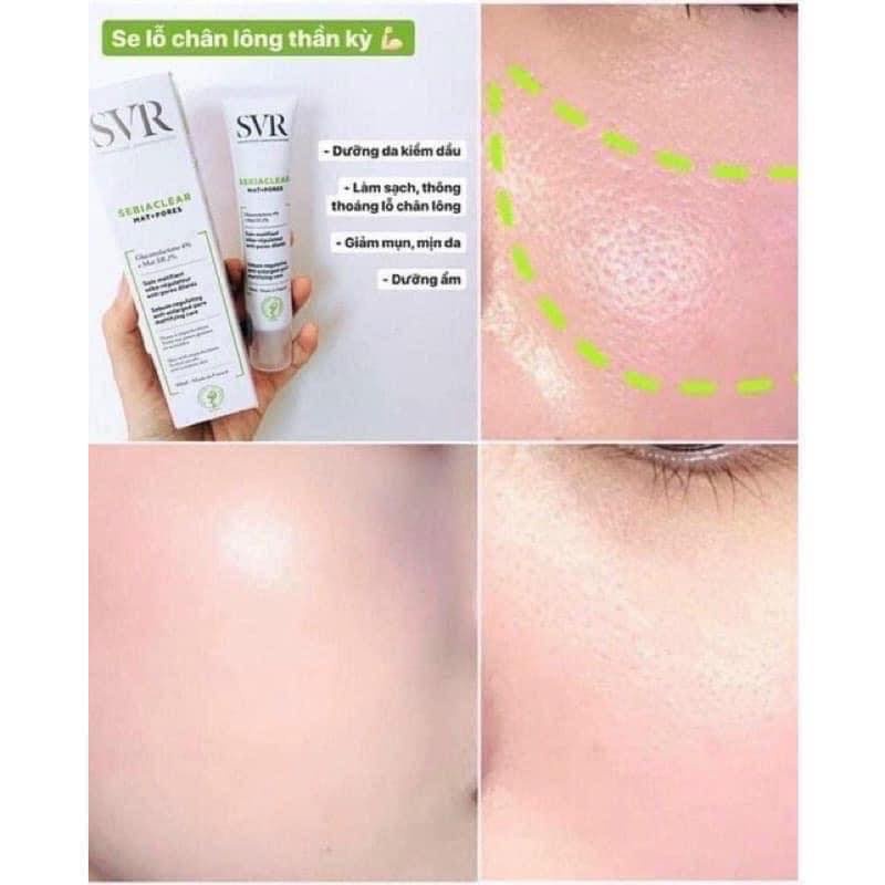 Kem Dưỡng Giảm Mụn, Kiểm Soát Dầu - SVR Active gel / Mat+pores 40ml - Balan Shop