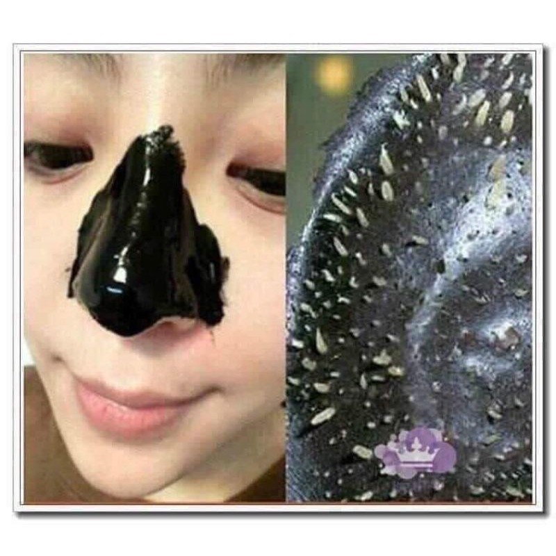 Lột Mụn Đầu Đen Blackhead Mistine