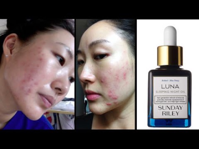 💙Dầu dưỡng da Sunday Riley Luna Sleeping Night Oil | BigBuy360 - bigbuy360.vn