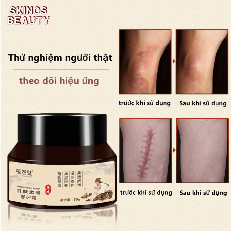 Kem cấp nước dưỡng ẩm se khít lỗ chân lông căng mịn làm mờ sẹo。