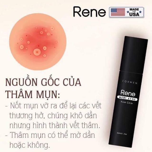 𝐊𝐞𝐦 Dưỡng cho Nam 𝐓𝐫𝐢̣ 𝐌𝐮̣𝐧 𝐑𝐞𝐧𝐞 𝐌𝐞𝐝𝐢 𝐀𝐜𝐧𝐞 - 𝐀𝐜𝐧𝐞 𝐂𝐥𝐞𝐚𝐫 