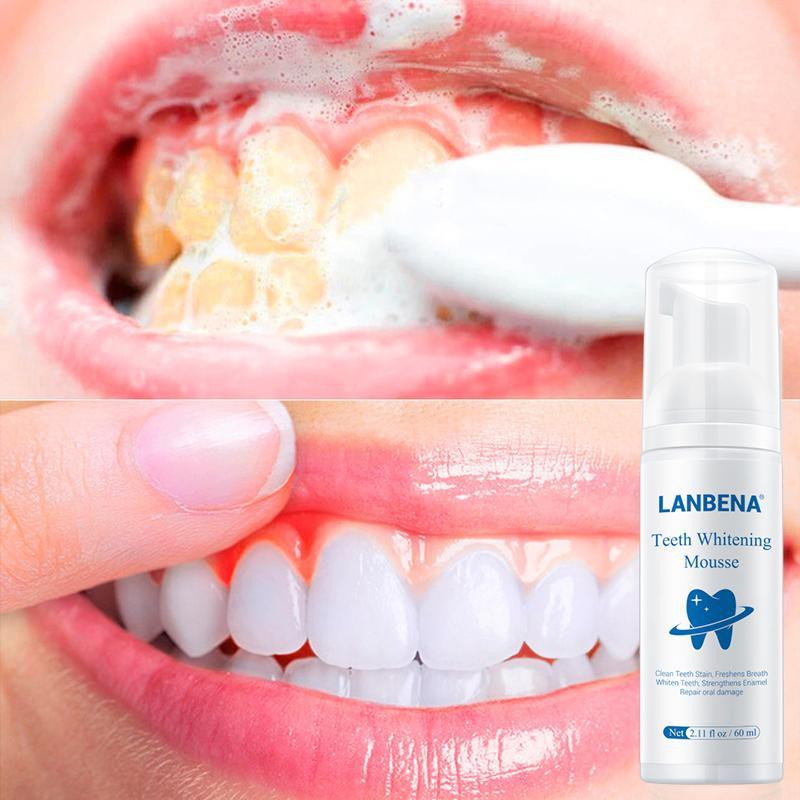 LANBENA Tinh chất làm trắng răng khử mùi hôi miệng kem đánh răng làm sạch răng tẩy vết ố Whitening Teeth Toothpaste Mousse