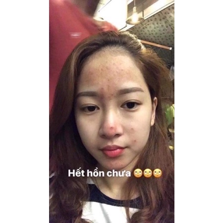 Cao lá nam ( mua trên 5 tặng 1 ) | BigBuy360 - bigbuy360.vn