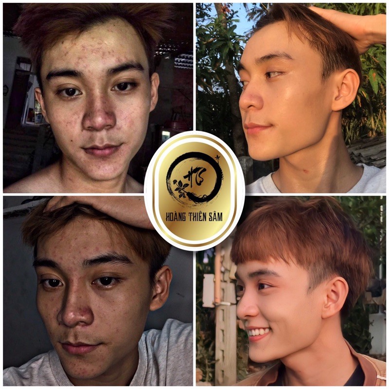 Tinh chất Hoàng Thiên Sâm⚡️Freeship ⚡️Mang đến 1 làn da trắng sáng, mịn màng