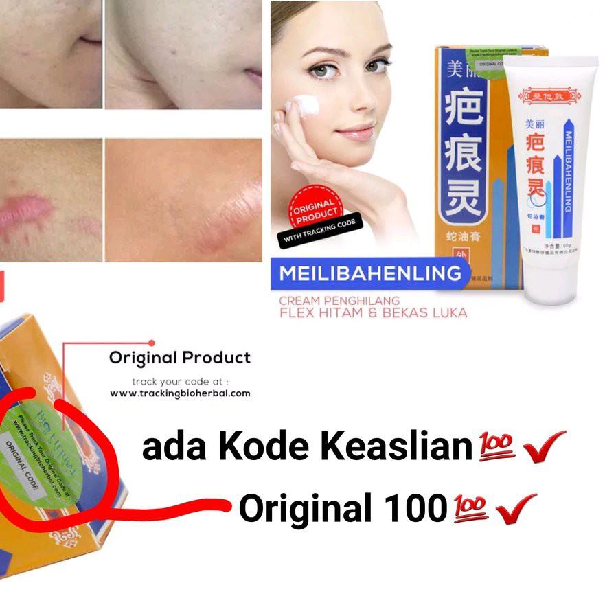 Kem Trị Sẹo Hiệu Quả Trong 7 Ngày Giúp Trị Thâm ✔
