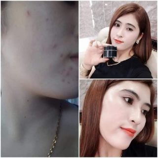 FACE Collagen X3