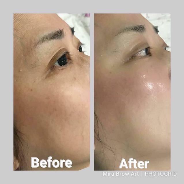 HG protein Collagen nhau thai tươi - Hàn Quốc