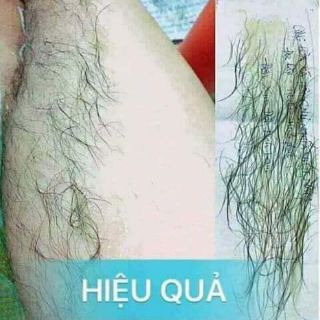 Combo Wax lông nách